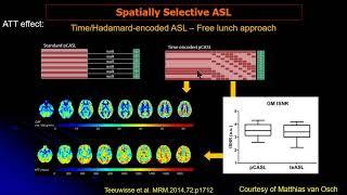 ISMRM MR Academy-Novel Labeling Techniques of ASL