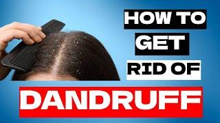 How to Get Rid of Dandruff Quickly | Medicated Shampoos For Seborrheic Dermatitis