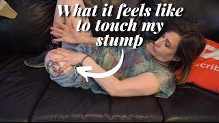 What It Feels Like To Touch My Above Knee Residual Limb (AK Amputee Stump)