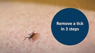 Remove a tick in 3 steps