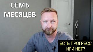 СЕМЬ МЕСЯЦЕВ ПОСЛЕ ВТОРОЙ ПЕРЕСАДКИ ВОЛОС