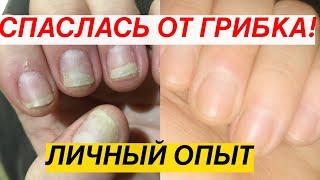 Как быстро и эффективно вылечить грибок на  руках. Мгновенный результат!