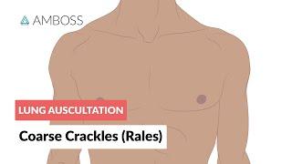 Coarse Crackles (Rales) - Lung Auscultation - Episode 3