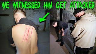 JASKO WAS BADLY INJURED IN THE PENNHURST ASYLUM FT OMARGOSHTV  (GONE WRONG)