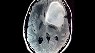 MIT student explains how curiosity saved his life