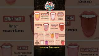 О чём говорит налёт на языке #shorts #полезныесоветы #здоровье #польза