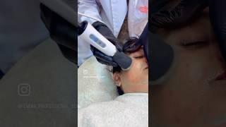 Oxygeneo treatment ️️️️️