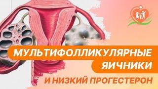  Мультифолликулярные яичники и низкий прогестерон