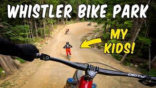 Here's why Whistler Bike Park is THE BEST!