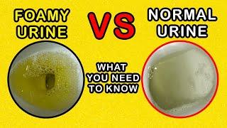 Foamy Urine vs Normal Urine: What is the difference and causes