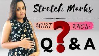 Stretch Marks - The Biggest Nightmare In Pregnancy | Top 5 FAQ | TruptWellness