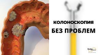 Как делать колоноскопию. Многопрофильная клиника "Скандинавия​".How to perform colonoscopy procedure