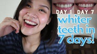 EFFECTIVE & AFFORDABLE TEETH WHITENING PRODUCTS | lovewendyxdiane