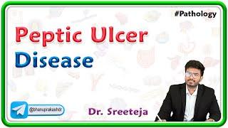 9. Peptic Ulcer Disease | USMLE Step 1 Pathology