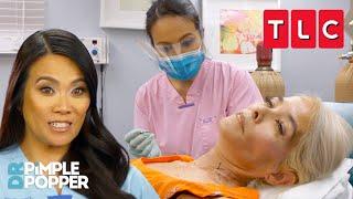 Every Pop from Season 3 | Dr. Pimple Popper | TLC