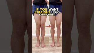 Leg Posture: How to fix your knock knee posture!