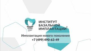 Базальная имплантация НОВОГО ПОКОЛЕНИЯ!