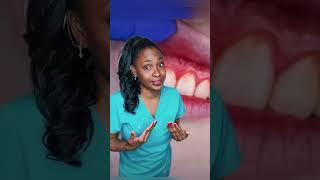 3 signs that you have gum disease #gums #dentalvideo