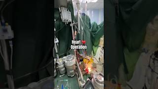 ️ Heart Operation ? Kaise Hoti hai Cardiac Surgery ? Dil ka operation ? Cardiac Bypass
