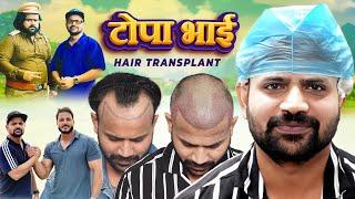 Youtuber Topa Bhai (Nadeem Bunny) New Look : Before & After Hair Transplant