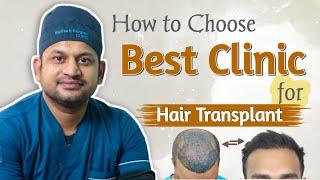 How to Choose Best Clinic for Hair Transplant || Best Hair Transplant Clinic in MP ||