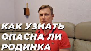 Как узнать опасна ли родинка.