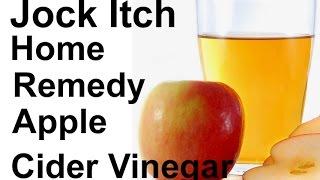 Jock Itch Home Remedy - Using Apple Cider Vinegar (Cure)