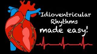 EMS Cardiology || Tachy Tuesday: Idioventricular Rhythms in EMS