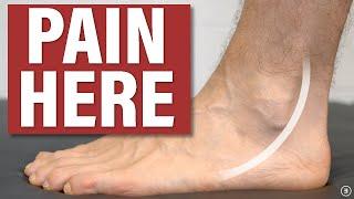 Peroneal Tendinopathy / Tendinitis: Causes & Treatment (Education | Strengthening | Stretching)