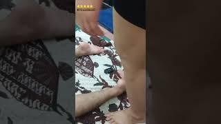 kretek tulang jari kaki