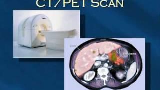 Pancreatic Cancer Patients Guide: 4 - Diagnostic Modalities