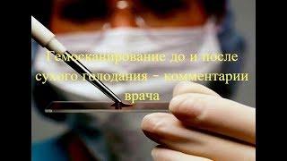 Результаты гемосканирования до и после сухого голодания с комментариями врача