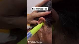 What do you think about ear impressions? Are they safe? #audiology #hear #hearingaids #hearingloss