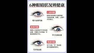 6种眼睛状况辨健康 #健康 #保养知识 #保健知识 #健康知识 #器官 #器官的求救信号 #身体的求救信号 #身体 #预防 #预防疾病 #养生 #保健