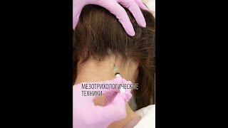 МЕЗОТРИХОЛОГИЧЕСКИЕ ТЕХНИКИ