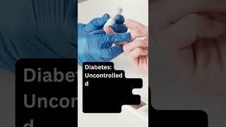 Yeast Infections | Infectious Diseases