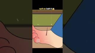 What Is Tetanus  #shorts #ytshorts #amazingfacts #factsinhindi #facts #factsmine #factoholic