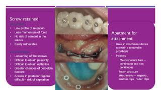 DENTAL IMPLANTS BASIC PRINCIPLES