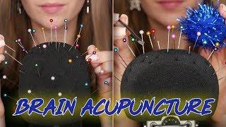 ИГЛОУКАЛЫВАНИЕ И МАССАЖ МОЗГА ДЛЯ МУРАШЕК АСМР | ACUPUNCTURE AND BRAIN MASSAGE FOR TINGLES ASMR