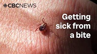 2 deaths linked to insect bites in Quebec — but experts say no reason to panic