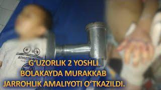 ҒУЗОРЛИК 2 ЁШЛИ БОЛАКАЙДА МУРАККАБ ЖАРРОҲЛИК АМАЛИЁТИ ЎТКАЗИЛДИ