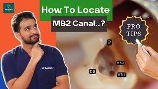 How to find MB2 canal? frequency and location