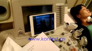 Beijing Konted wireless linear ultrasound probe C10L, wireless ultrasound