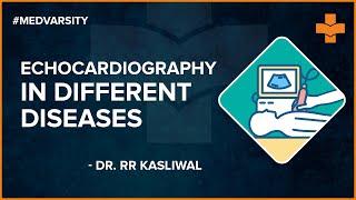 Role of echocardiography in different diseases | RR Kasliwal | 2D Echocardiography | Medvarsity