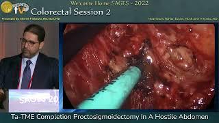 Ta-TME Completion Proctosigmoidectomy In A Hostile Abdomen