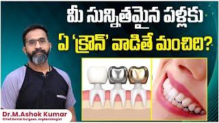 Do You Know Which Dental Crown Is Best for You? | Dental Implant Methods | Eledent Dental Hospitals