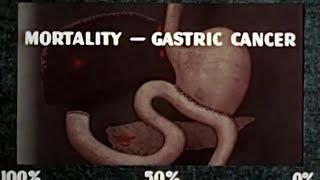 Cancer: The Problem of Early Diagnosis (NCI and American Cancer Society, 1949)