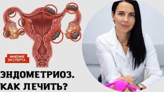 КАК ЛЕЧИТЬ ЭНДОМЕТРИОЗ?