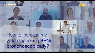 How to increase my yield diagnosing SPNs bronchoscopically?