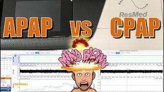 APAP versus CPAP Comparison : Which is better for your sleep? 